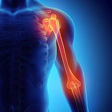 Shoulder & Elbow Replacement Image